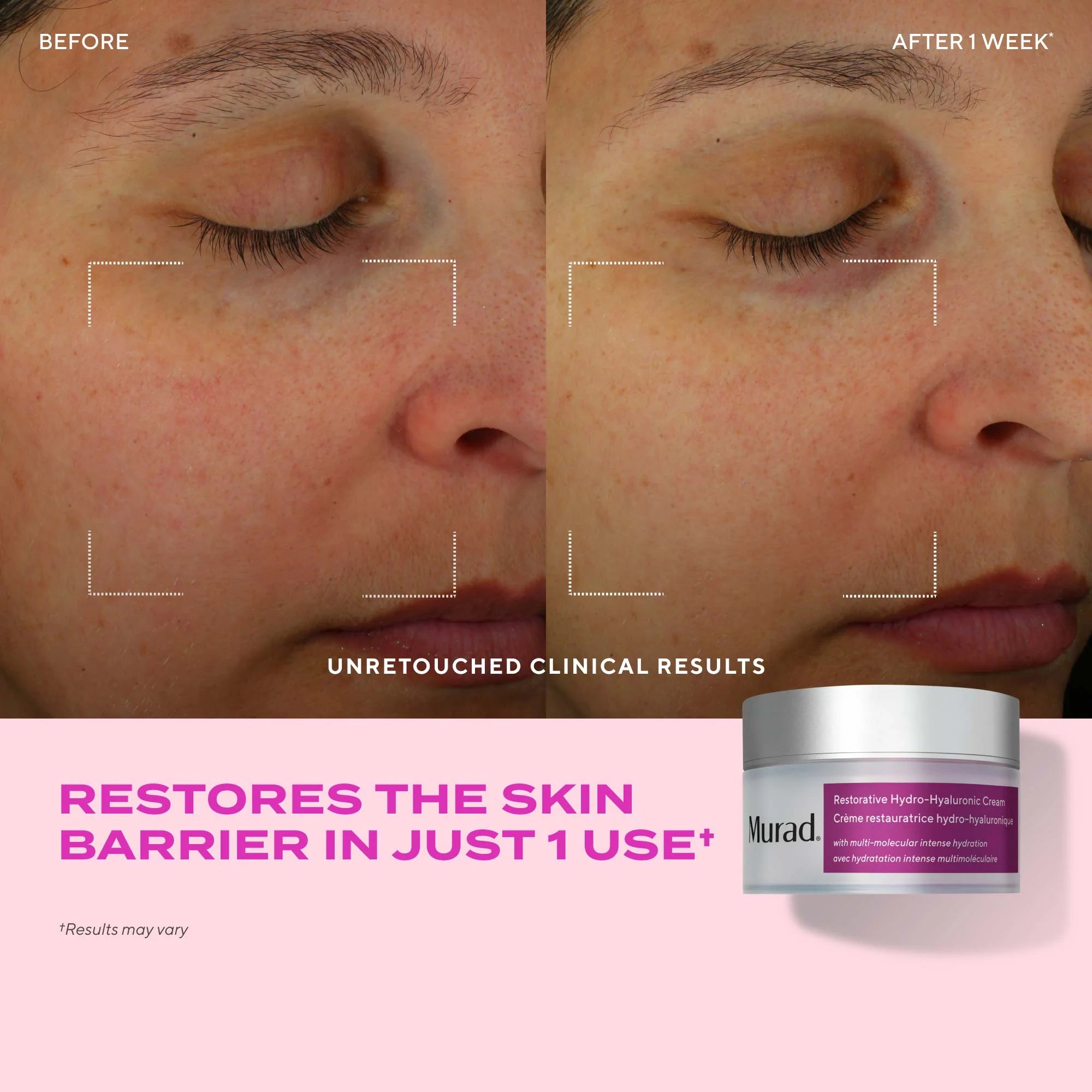 Restorative Hydro-Hyaluronic Cream 50mL - Crema Hidratante con ácido Hialurónico 24h de hidratación