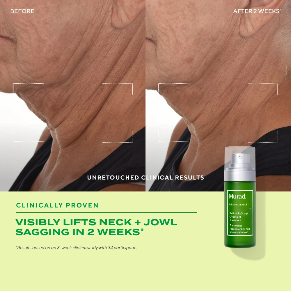 Retinal ReSculpt™ Overnight Treatment - Tratamiento de noche antienvejecimiento y firmeza ★ BEST UP ★