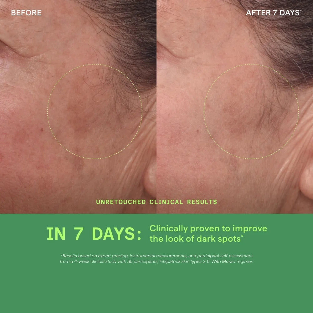 Rapid Dark Spot Correcting Serum - Sérum AM y PM corrector de manchas oscuras