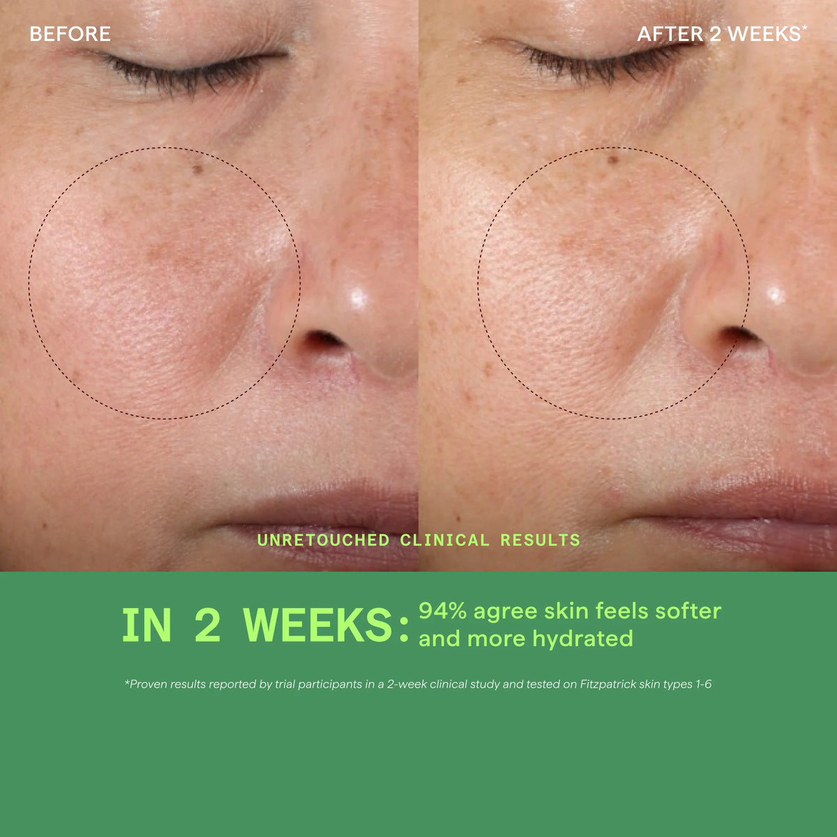 Vita-C Glycolic Serum - Sérum de Vitamina C + Ácido Glicólico