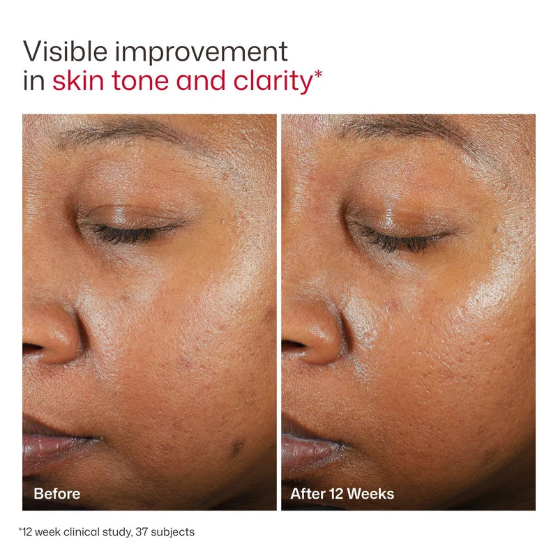 UV Clear SPF 46 con Color - Protector Sola con Color para Todo Tipo de Piel | Tendencia al Acné y Rosácea