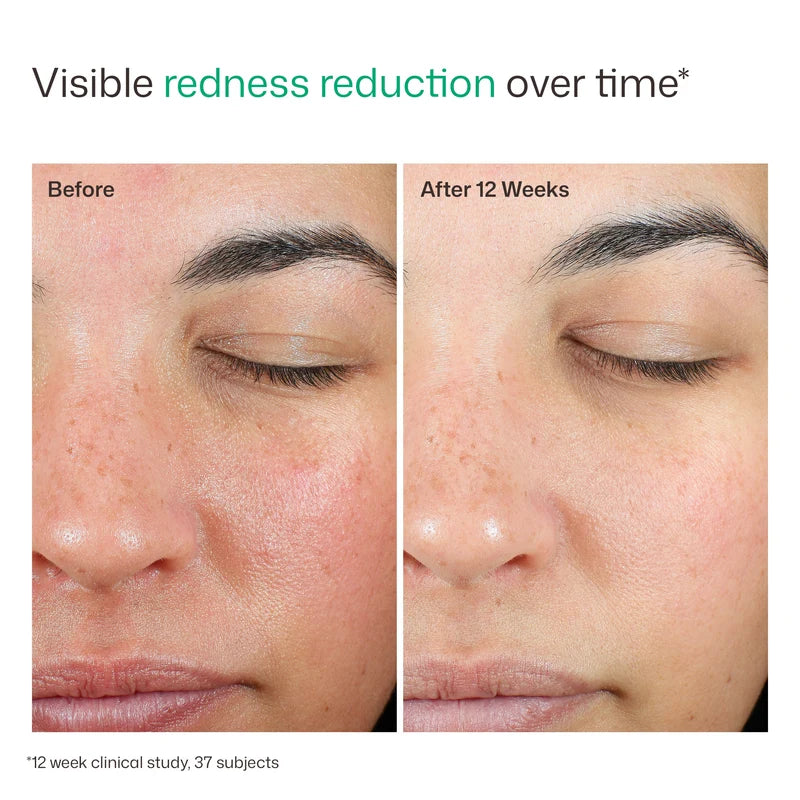 UV Skin Recovery EltaMD - Protector solar facial SPF 50 de amplio espectro ideal para pieles con rosácea