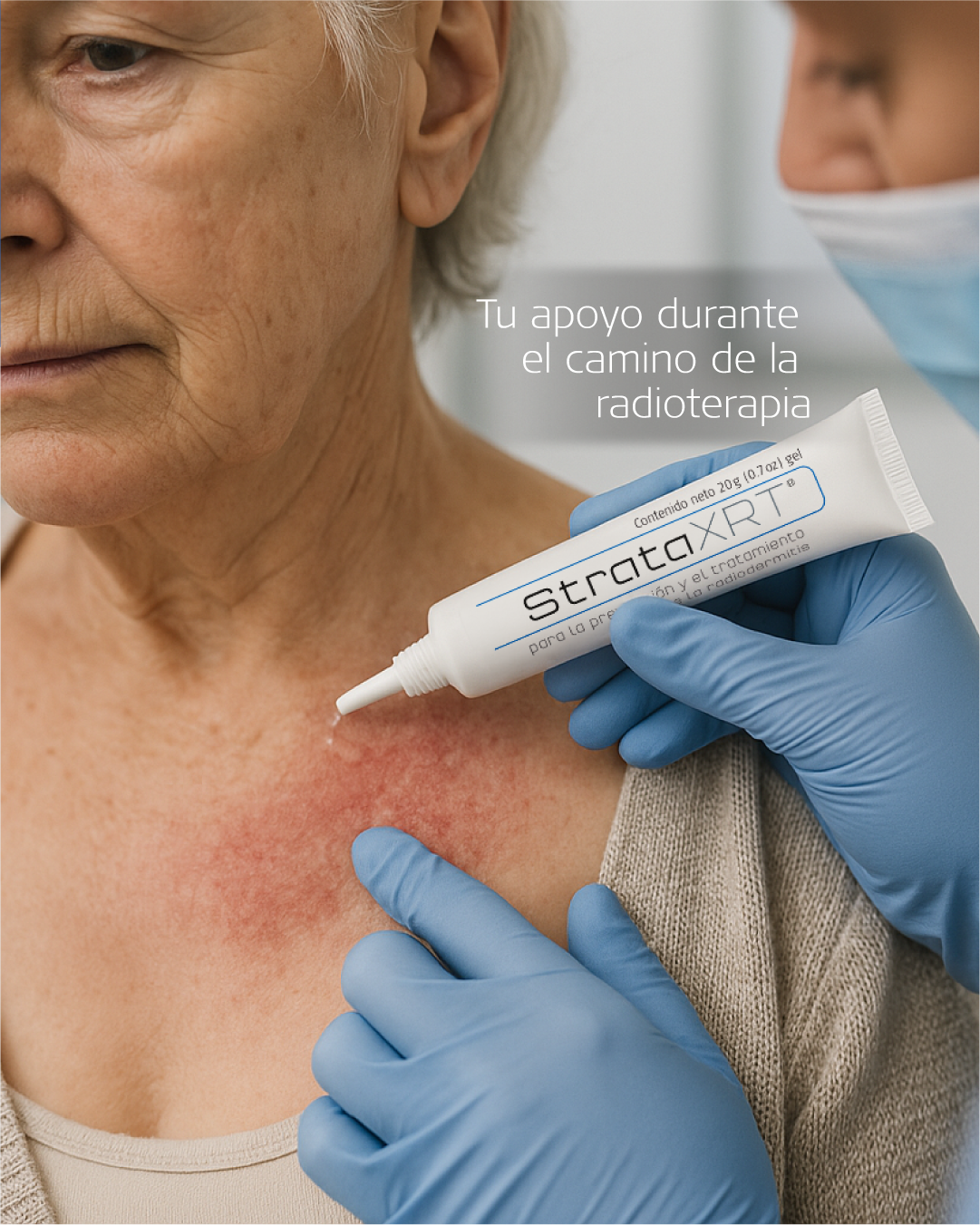StrataXRT - Gel para el cuidado de la piel durante la radioterapia