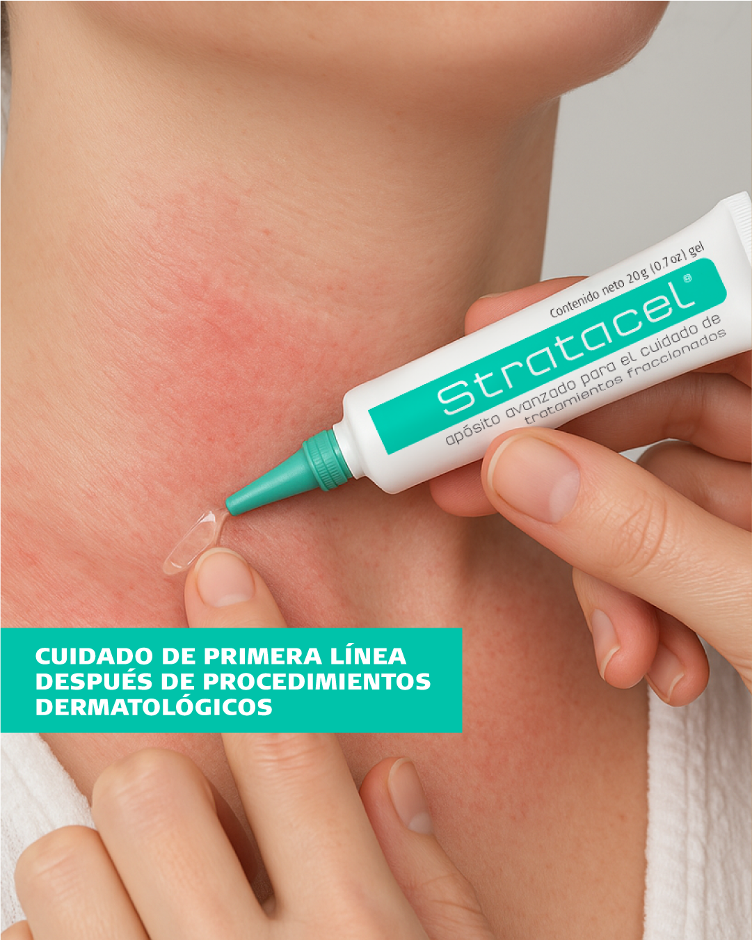 Stratacel - Gel Reparador Post Procedimiento | Cuidado Post Láser