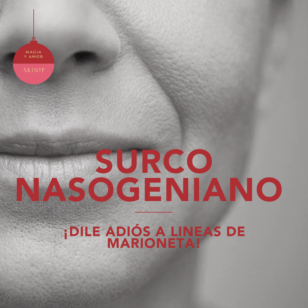 Surco Nasogeniano y marioneta ¡Dile adiós a lineas que te envejecen! Descuento NAVIDAD!
