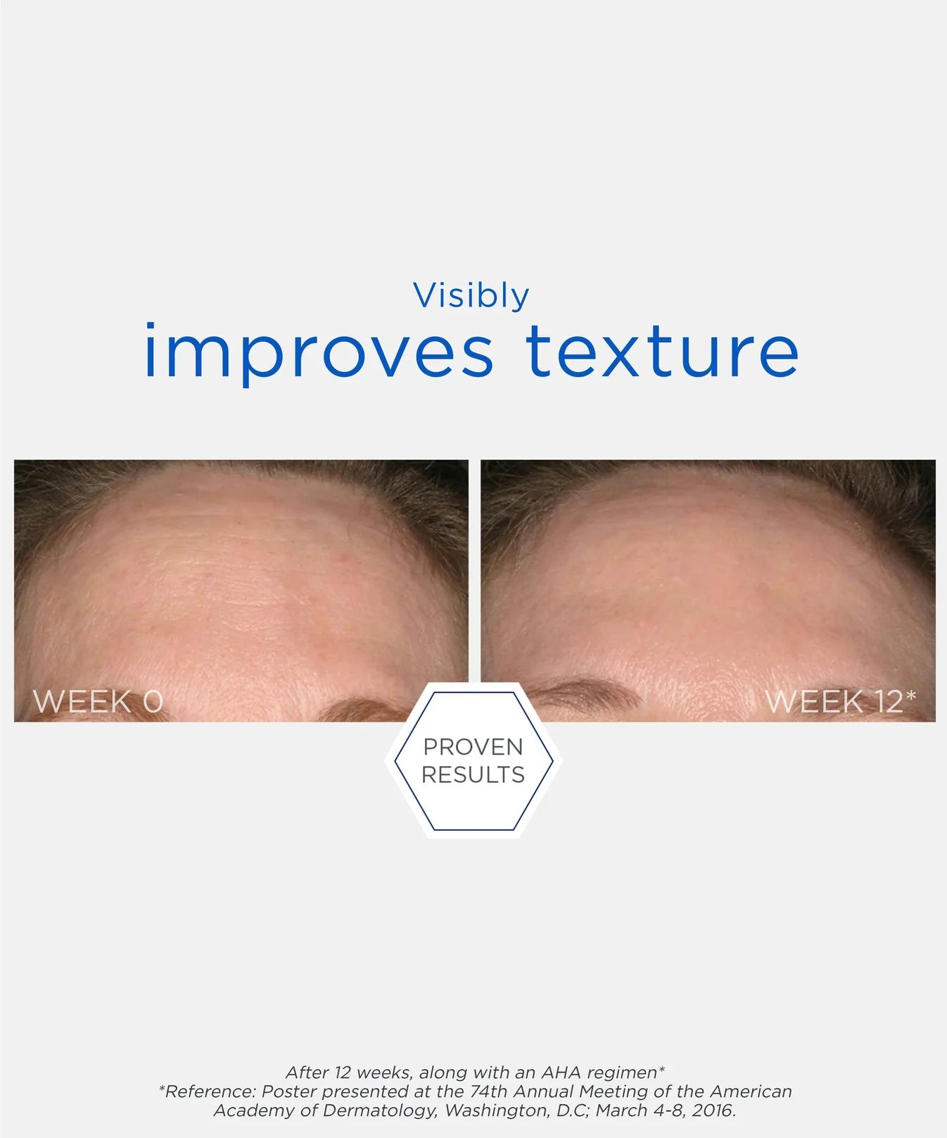 Smooth Surface Daily Peel / Tratamiento renovador antiarrugas y alisa la piel sin enjuague en pétalos para lograr Piel Lisa ★ BEST UP ★