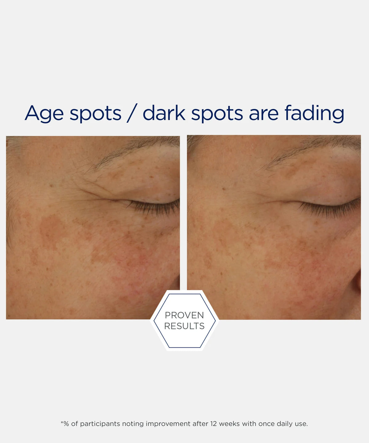 Potent Retinol Complex - Potente sérum nocturno con retinol ★ BEST UP ★
