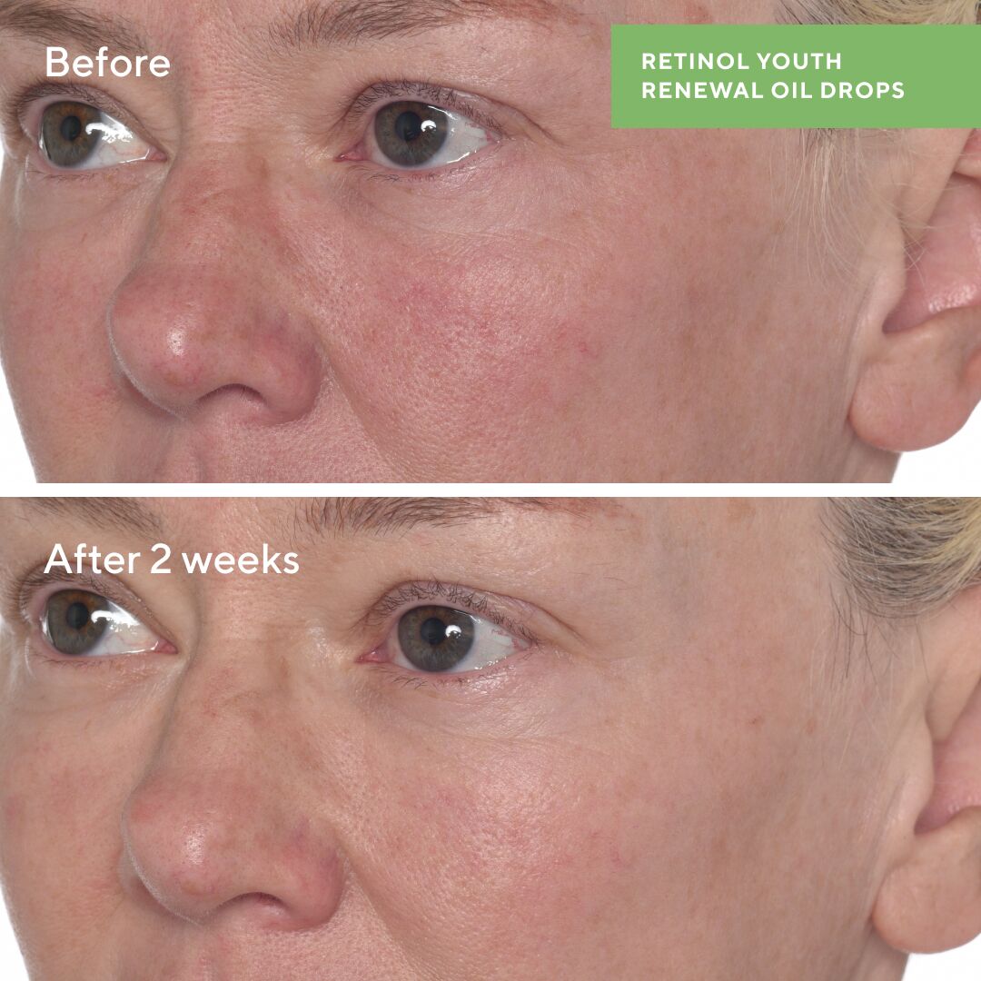 Retinol Youth Renewal Face Oil Drops - Sérum de RETINOL reafirmante y nutritivo para suavizar visiblemente las arrugas