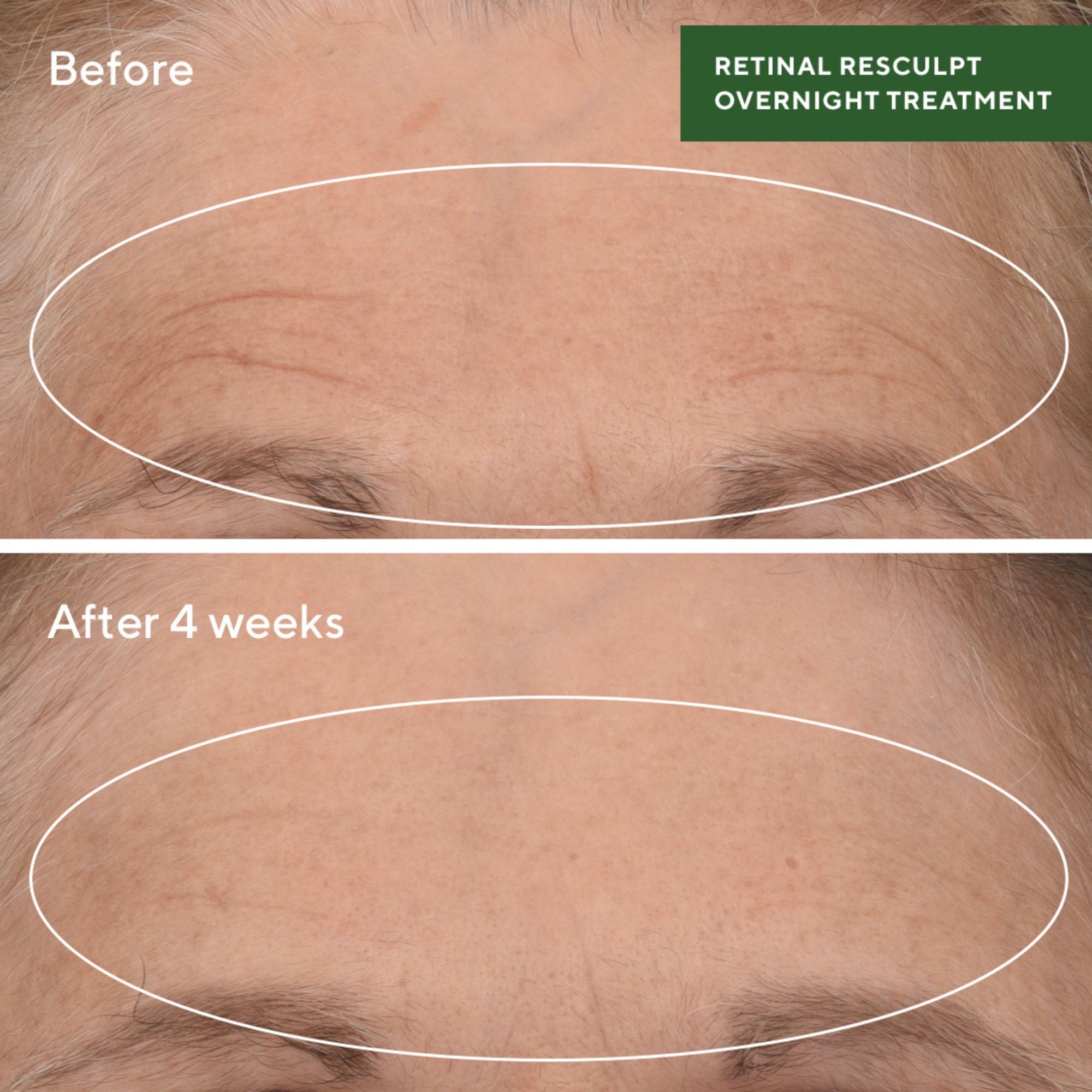 Retinal ReSculpt™ Overnight Treatment/ Tratamiento de noche antienvejecimiento y firmeza BESTSTAR