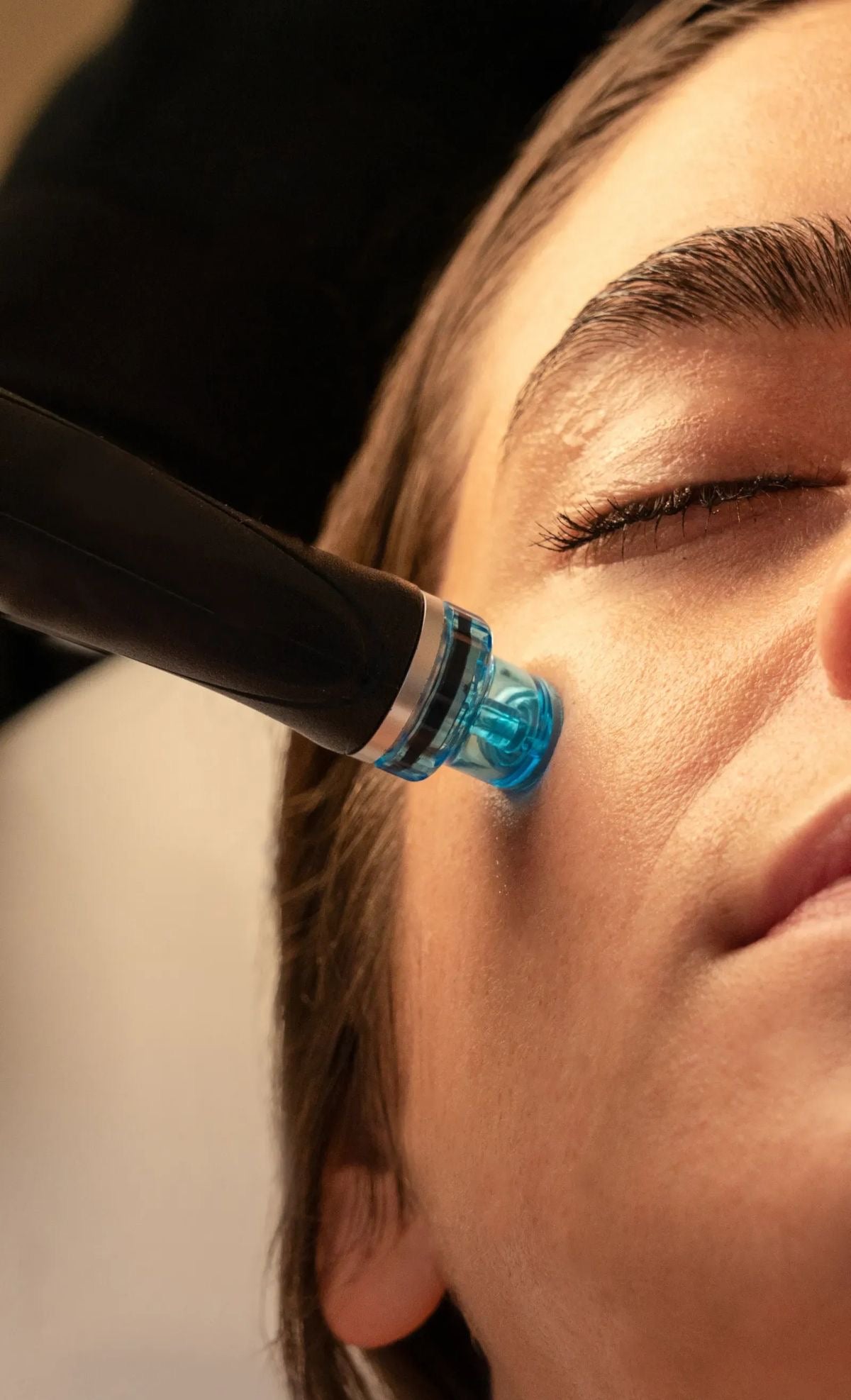 Hydrafacial Tratamiento 4 en 1 - Limpia, Hidrata, Da brillo, Despigmenta permitido en embarazadas