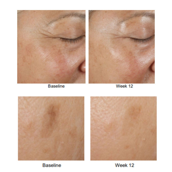 Potent Retinol Complex