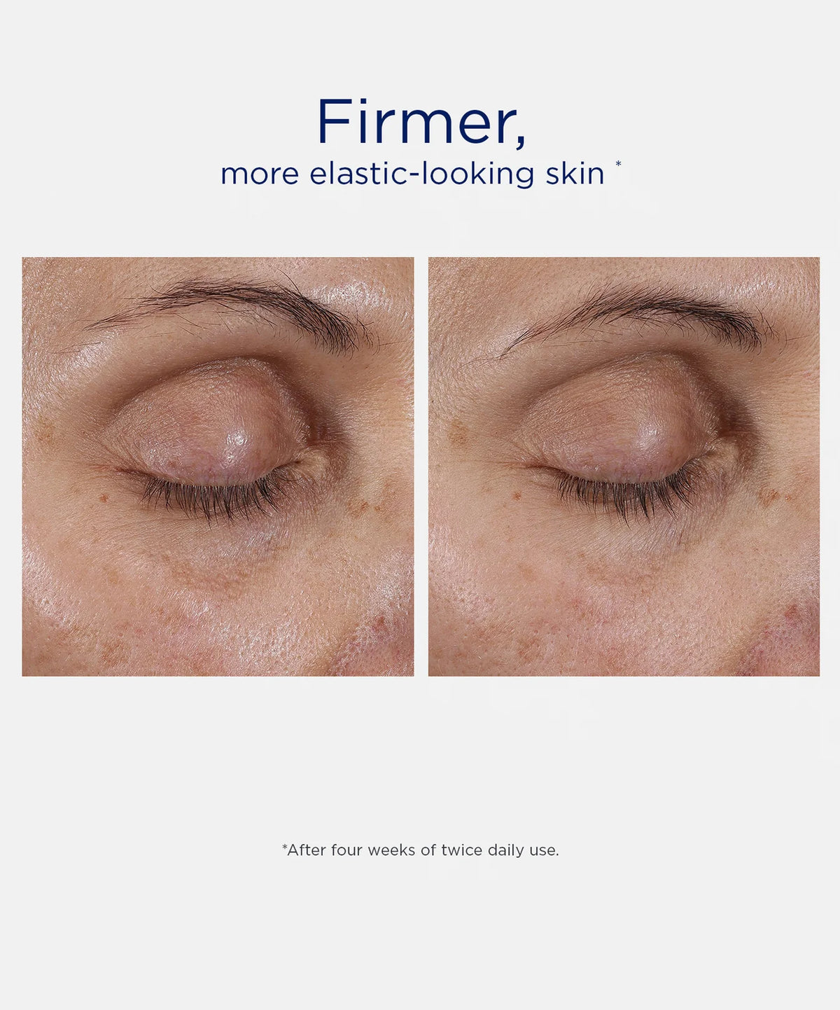 Intensive Eye Therapy con MicroDiPeptide - Contorno de ojos multifuncional antiedad | Trata Arrugas, Bolsas y Ojeras