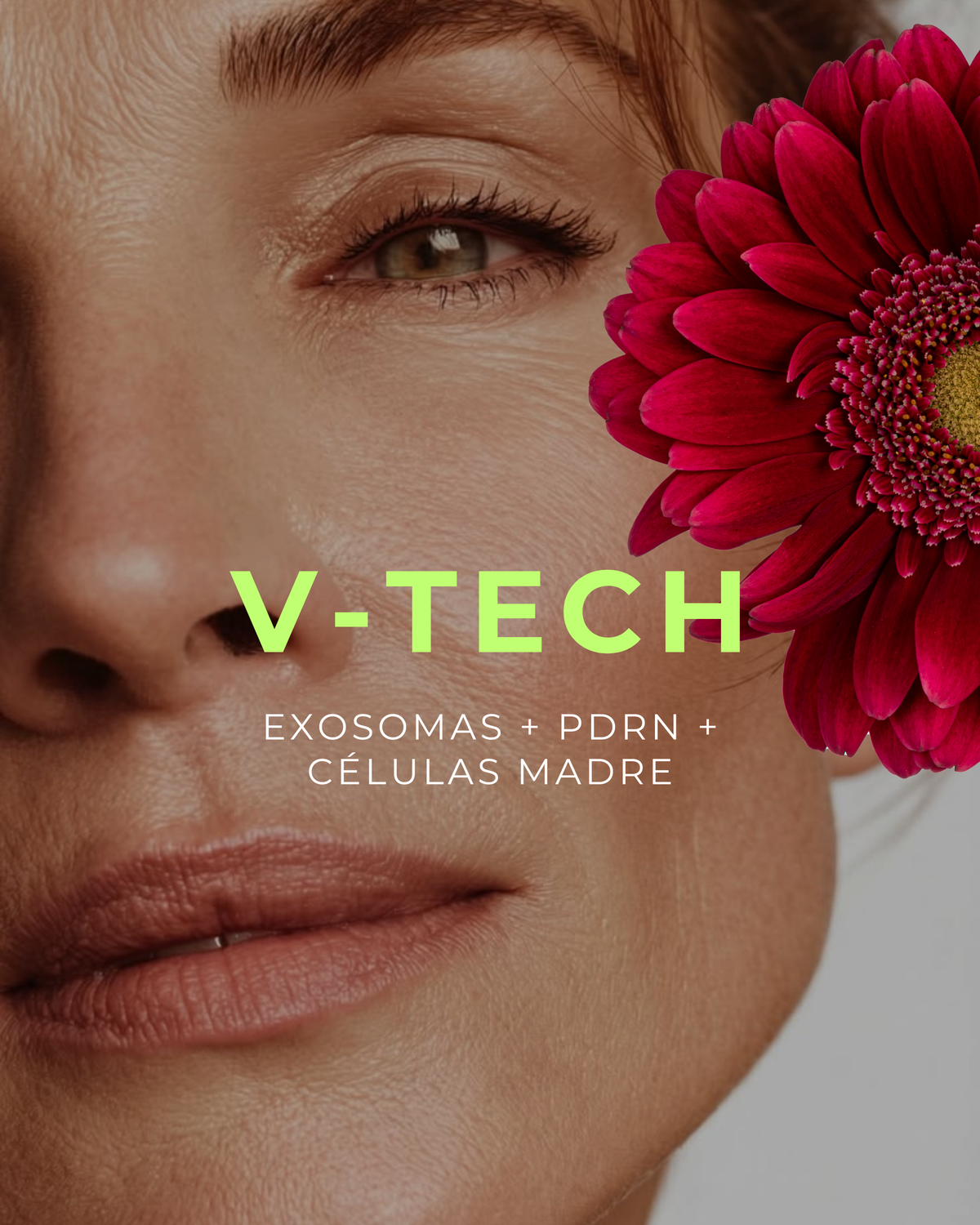 V-Tech: Regeneración Total con Exosomas + PDRN + Células Madre — 3 grandes activos en 1 tratamiento para rejuvenecer y resetear tu piel