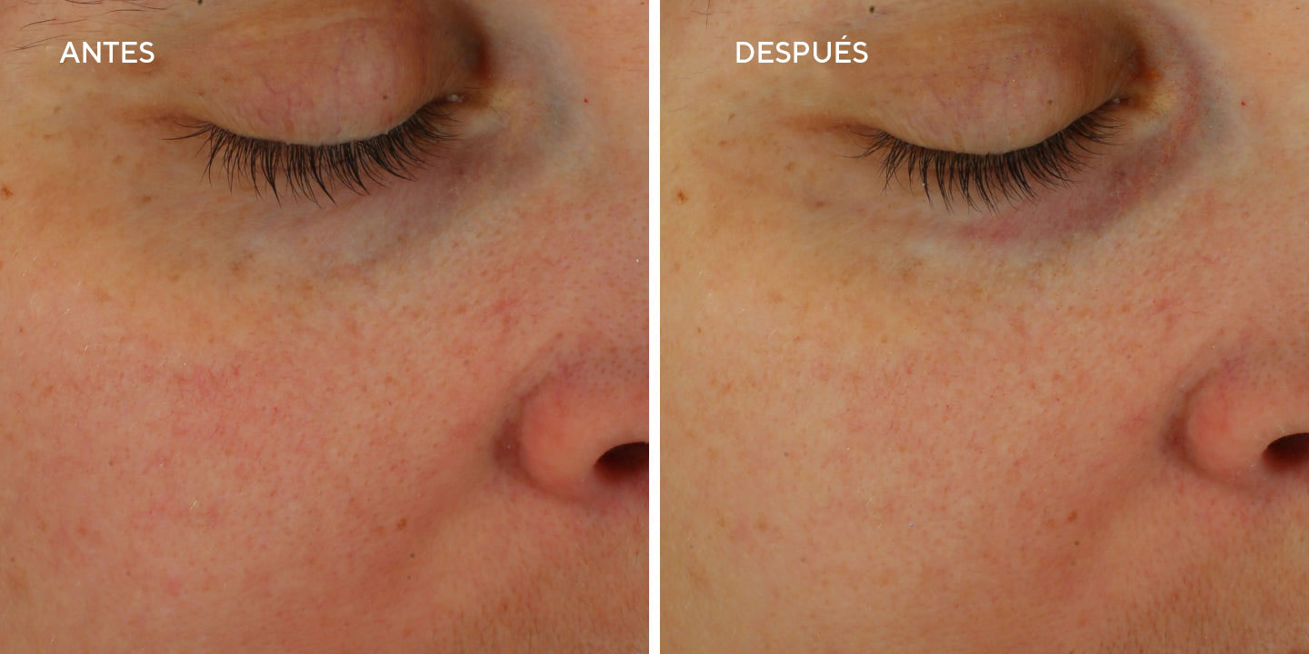 Restorative Hydro-Hyaluronic Cream 50mL - Crema Hidratante con ácido Hialurónico 24h de hidratación
