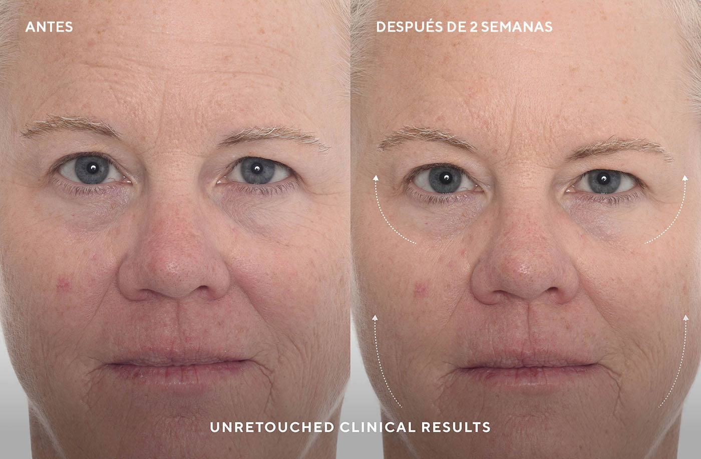 Retinal ReSculpt Overnight Cream - Crema Antiedad de Noche con efecto lifting