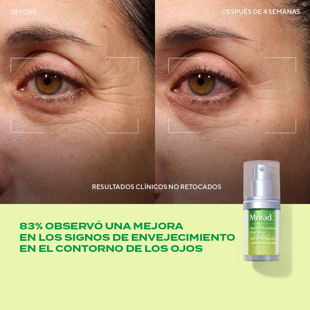 Derm Clinic: Target Eye Wrinkles Value Set - Kit Antiedad para Contorno de Ojos con Retinol