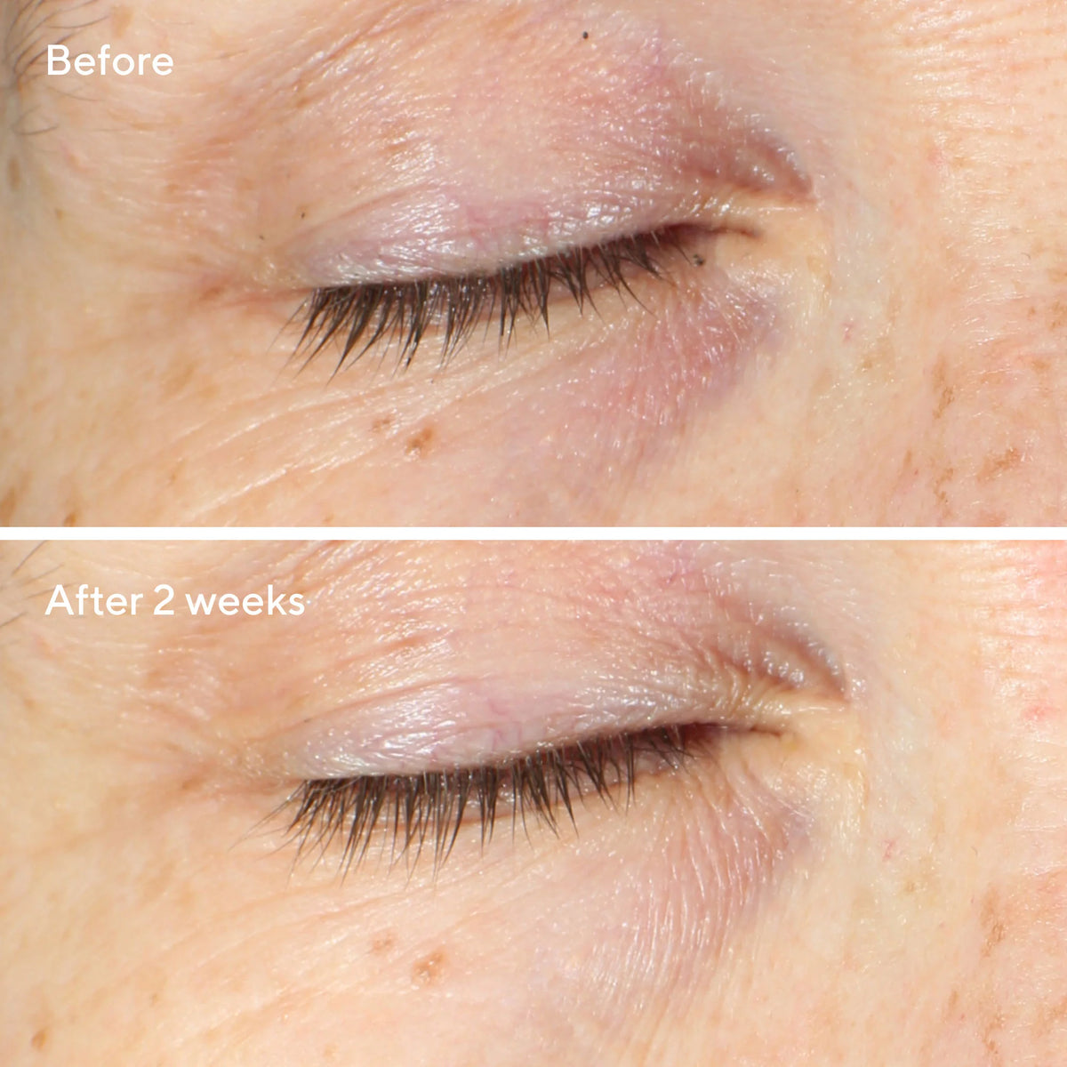 Vita-C Eyes Dark Circle Corrector - Contorno de ojos con vitamina C | Tratamiento ojeras oscuras y bolsas