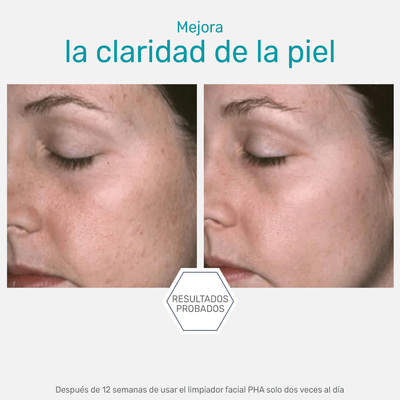 PHA Cleanser Neostrata 200 ml - Gel limpiador facial suave para todo tipo de piel