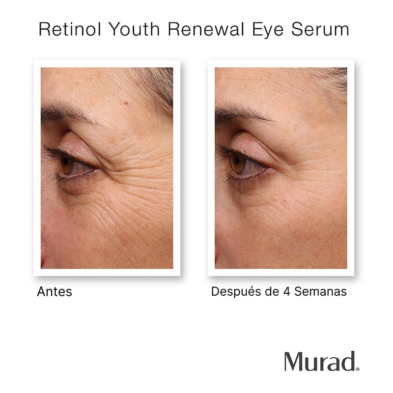 Retinol Youth Renewal Eye Serum / Contorno de ojos con retinol antiarrugas
