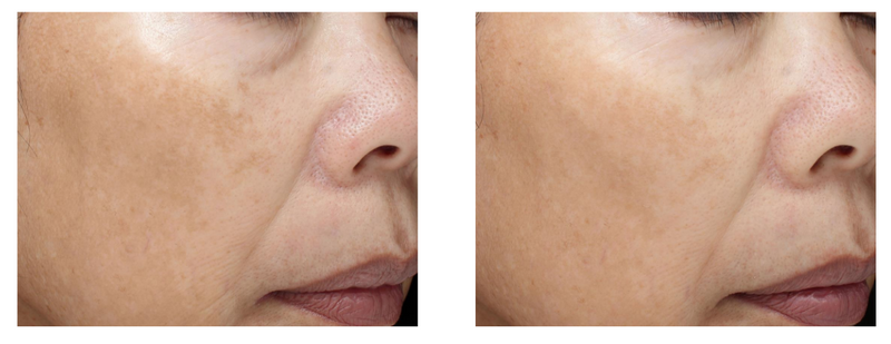 Essential C Overnight Barrier Repair Cream