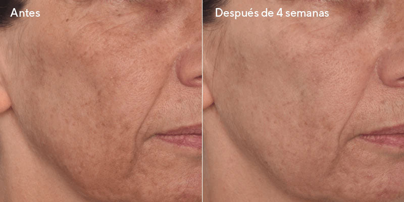 Pack Murad Brighten Limpiador y Serum Facial Vita C Glycolic