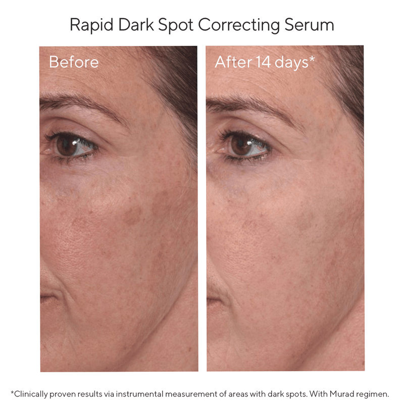 Pack Murad Despigmentante Serum Rapid Dark Spot Tamaño grande + 3 productos travel set linea naranja