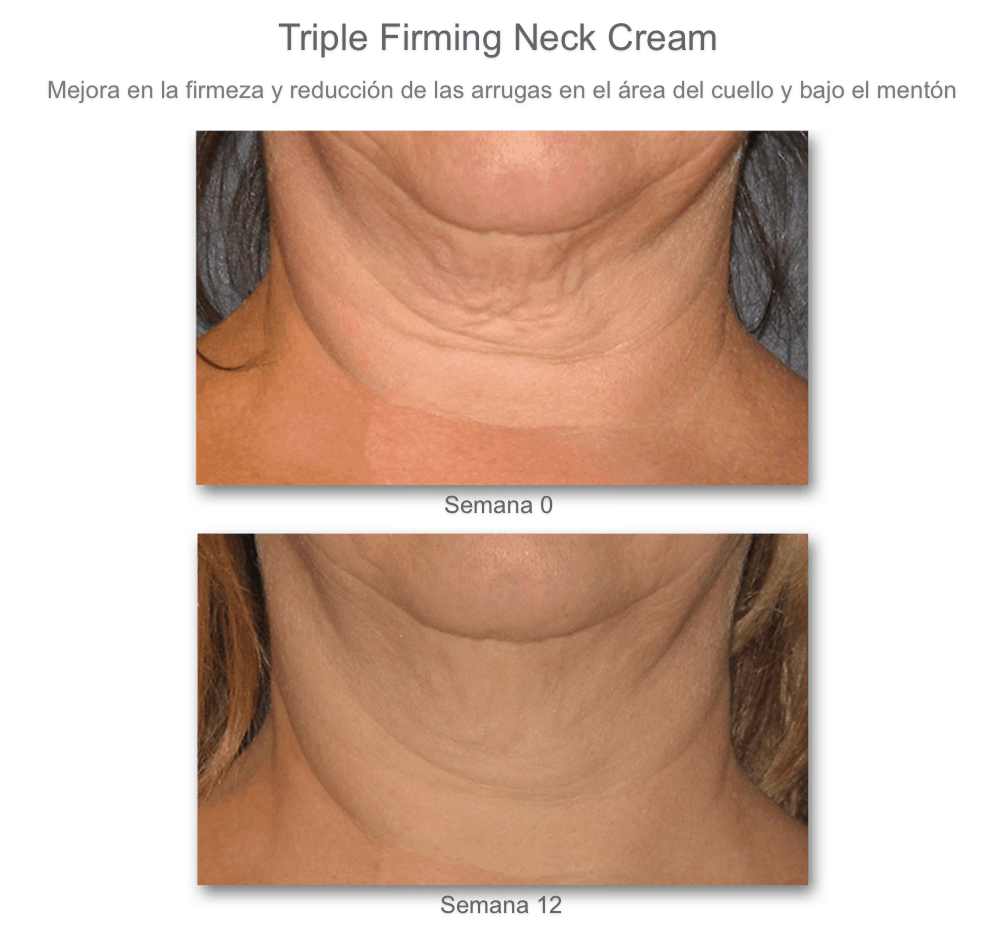 Triple Firming Neck Cream / Crema de Cuello y escote Triple Reafirmante