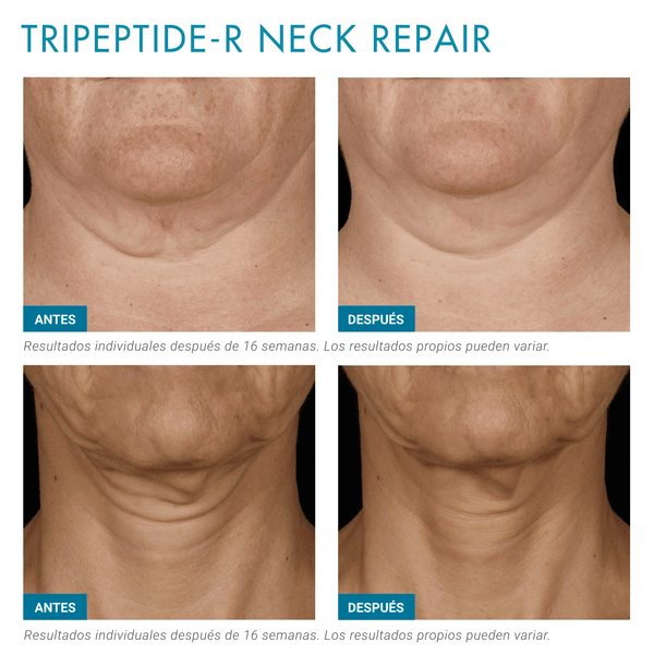 Tripeptide-R Neck Repair / Tratamiento antiage con retinol para cuello