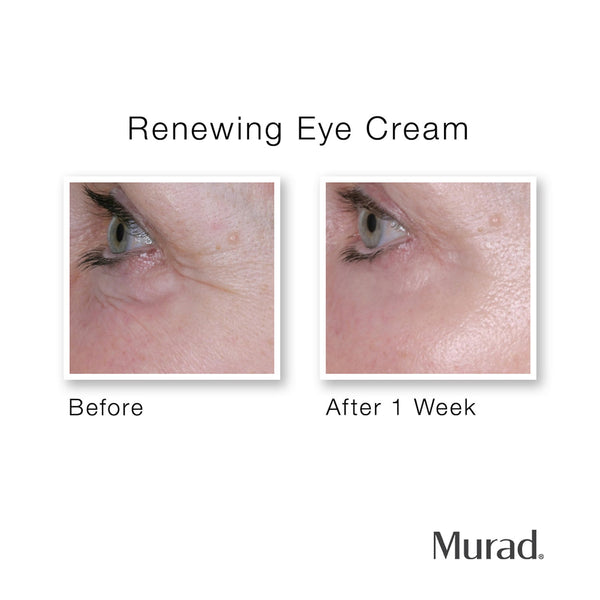 Renewing Eye Cream